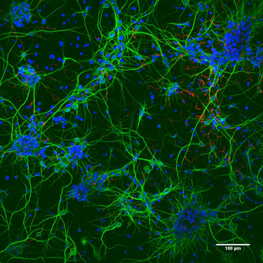 Regeneración neural