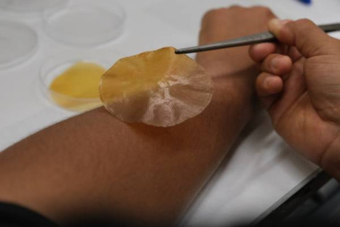 sustancia porosa que se activa con la luz solar y que se aplica sobre las heridas, como una especie de tirita, para reducir el crecimiento bacteriano.