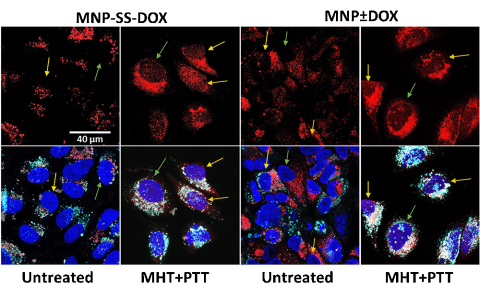 Imágenes tomadas por microscopio confocal que muestran cómo es el efecto de los tratamientos térmicos en la liberación de fármacos (doxorrubicina) dentro de las células tumorales Foto:ICMM/CSIC. 