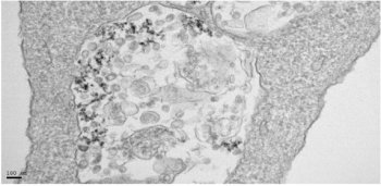 Iron oxide and iron oxyhydroxide nanoparticles impair SARS-CoV-2 infection of cultured cells