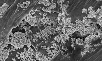 Nanoflores sobre microplasticos