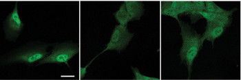Imágenes de inmunofluorescencia de células de retina humana, dónde se muestra la localización nuclear y citoplásmatica de la proteína YAP (verde) en función de las propiedades mecánicas del material utilizado como matriz extracelular. Foto: CNIC