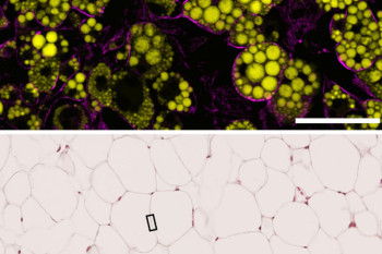 Adipocytes differentiated in vitro, containing fat deposits (yellow) and the Cav-1 protein in the cell membrane (magenta). Scale bar, 100 microns. b, Mouse adipose tissue. Scale bar, 100 microns. c, Electron microscopy images showing regions of adipocyte membrane similar to that indicated by the boxed area in b. Caveolae are visible as membrane invaginations (arrowheads). The genetically modified adipocyte expressing non-phosphorylatable Cav-1 (bottom panel) accumulates caveolae because they cannot flatten 